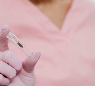 ¿Cuáles son los tres tipos de implantes dentales? Guía completa para pacientes en 2025